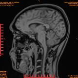 2026-04-15/Brain/AAHead Scout/0072-.png