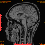 2026-04-15/Brain/AAHead Scout/0073-.png