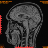 2026-04-15/Brain/AAHead Scout/0074-.png