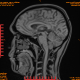 2026-04-15/Brain/AAHead Scout/0075-.png
