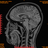 2026-04-15/Brain/AAHead Scout/0076-.png