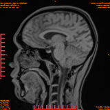 2026-04-15/Brain/AAHead Scout/0078-.png
