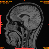 2026-04-15/Brain/AAHead Scout/0079-.png