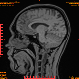 2026-04-15/Brain/AAHead Scout/0080-.png