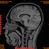 2026-04-15/Brain/AAHead Scout/0081-.png