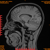 2026-04-15/Brain/AAHead Scout/0083-IM101.png