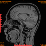 2026-04-15/Brain/AAHead Scout/0084-IM102.png