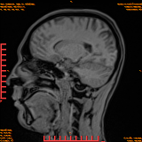 2026-04-15/Brain/AAHead Scout/0085-IM103.png