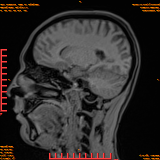 2026-04-15/Brain/AAHead Scout/0086-IM104.png