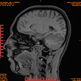 2026-04-15/Brain/AAHead Scout/0087-IM105.png