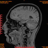 2026-04-15/Brain/AAHead Scout/0088-IM106.png