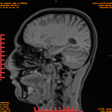 2026-04-15/Brain/AAHead Scout/0089-IM107.png