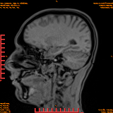 2026-04-15/Brain/AAHead Scout/0090-IM108.png