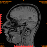 2026-04-15/Brain/AAHead Scout/0091-IM109.png