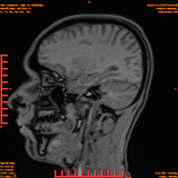 2026-04-15/Brain/AAHead Scout/0092-IM110.png