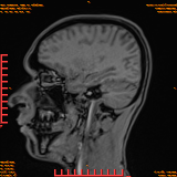 2026-04-15/Brain/AAHead Scout/0093-IM111.png