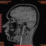 2026-04-15/Brain/AAHead Scout/0094-IM112.png