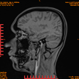 2026-04-15/Brain/AAHead Scout/0095-IM114.png