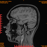 2026-04-15/Brain/AAHead Scout/0096-IM113.png