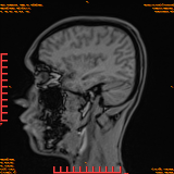 2026-04-15/Brain/AAHead Scout/0097-IM115.png
