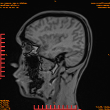 2026-04-15/Brain/AAHead Scout/0098-IM116.png