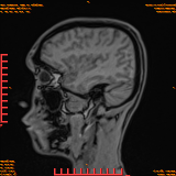 2026-04-15/Brain/AAHead Scout/0099-IM117.png