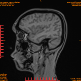2026-04-15/Brain/AAHead Scout/0100-IM118.png