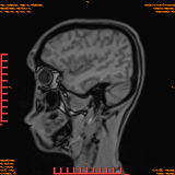 2026-04-15/Brain/AAHead Scout/0101-IM119.png