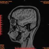 2026-04-15/Brain/AAHead Scout/0103-IM121.png
