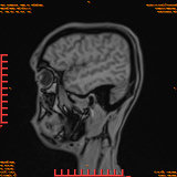 2026-04-15/Brain/AAHead Scout/0105-IM123.png