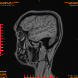 2026-04-15/Brain/AAHead Scout/0106-IM124.png