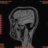 2026-04-15/Brain/AAHead Scout/0107-IM125.png