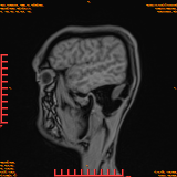 2026-04-15/Brain/AAHead Scout/0108-IM126.png