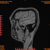 2026-04-15/Brain/AAHead Scout/0109-IM127.png