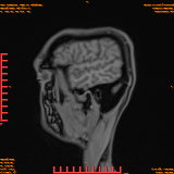 2026-04-15/Brain/AAHead Scout/0110-IM128.png