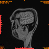 2026-04-15/Brain/AAHead Scout/0111-IM129.png