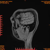 2026-04-15/Brain/AAHead Scout/0112-IM130.png
