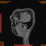 2026-04-15/Brain/AAHead Scout/0113-IM131.png