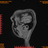 2026-04-15/Brain/AAHead Scout/0114-IM132.png