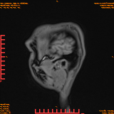 2026-04-15/Brain/AAHead Scout/0115-IM133.png