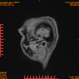2026-04-15/Brain/AAHead Scout/0116-IM134.png