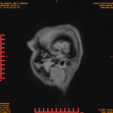 2026-04-15/Brain/AAHead Scout/0117-IM135.png