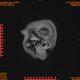 2026-04-15/Brain/AAHead Scout/0119-IM137.png