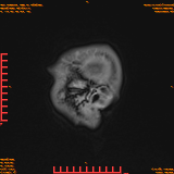 2026-04-15/Brain/AAHead Scout/0120-IM138.png