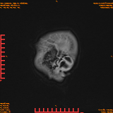 2026-04-15/Brain/AAHead Scout/0121-IM139.png