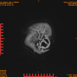 2026-04-15/Brain/AAHead Scout/0122-IM140.png