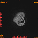 2026-04-15/Brain/AAHead Scout/0123-IM141.png