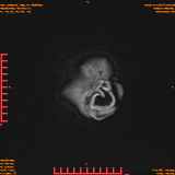 2026-04-15/Brain/AAHead Scout/0124-IM142.png