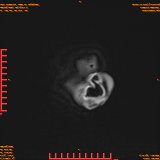 2026-04-15/Brain/AAHead Scout/0125-IM143.png
