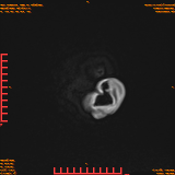 2026-04-15/Brain/AAHead Scout/0126-IM144.png